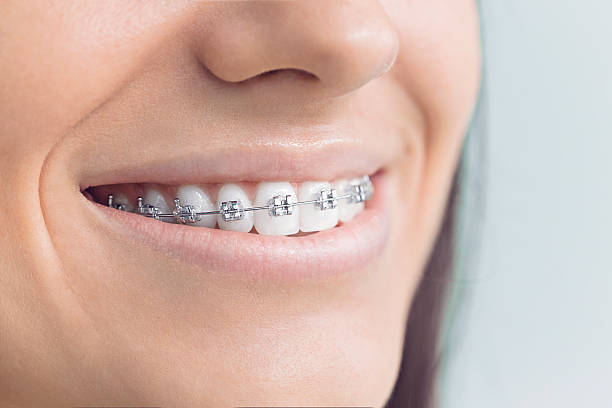 Best Wisdom Tooth Removal  in Bawcomville, LA